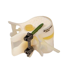 BoneMatrix